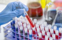 Transfusion Medicine/ Blood Centre